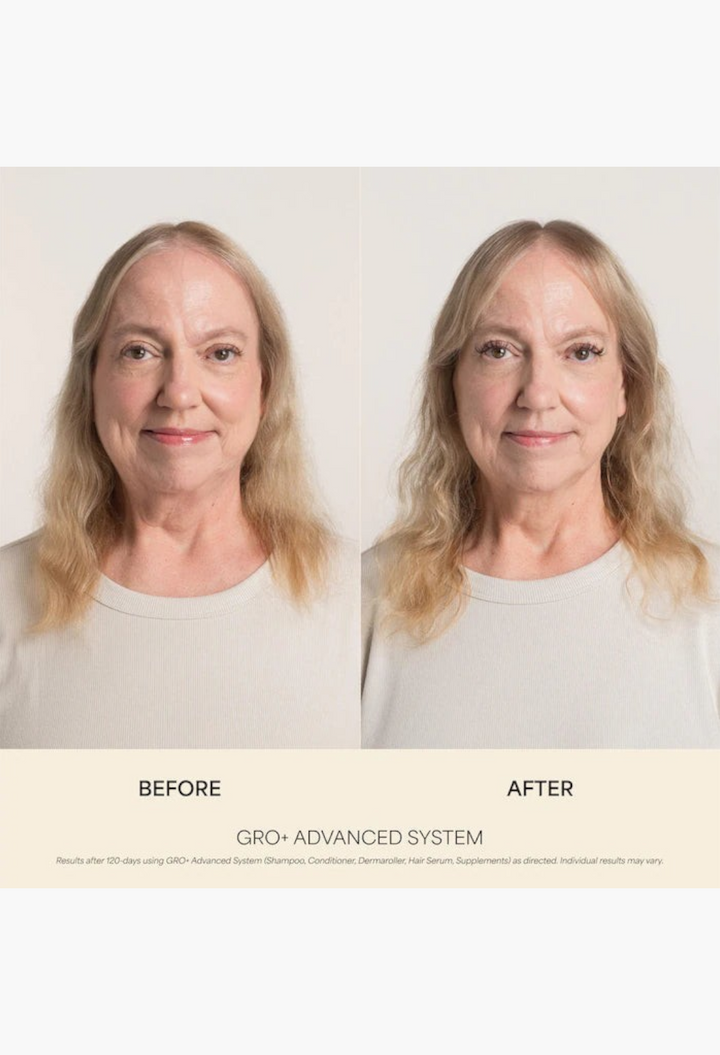 GLAM MODA before and after comparison of a woman showing hair volume improvement using GRO+ Advanced hair care system.