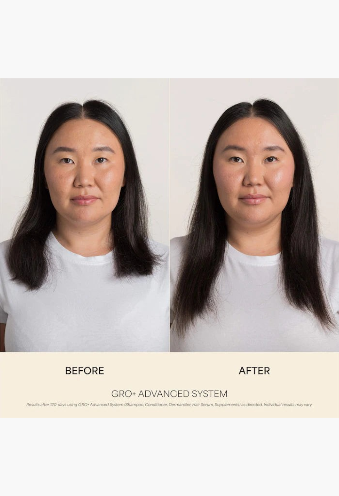 GLAM MODA before and after results of GRO+ Advanced Balancing shampoo and conditioner set on thinning hair