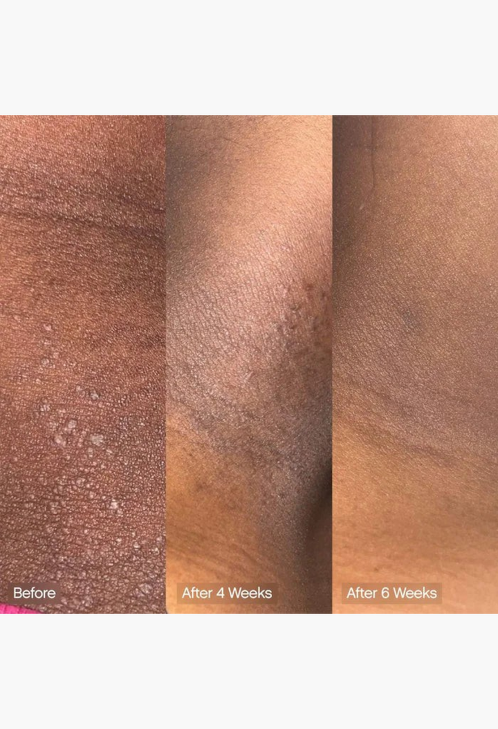 GLAM MODA Faded body bar before and after results showing skin brightening and reduced dark spots over six weeks