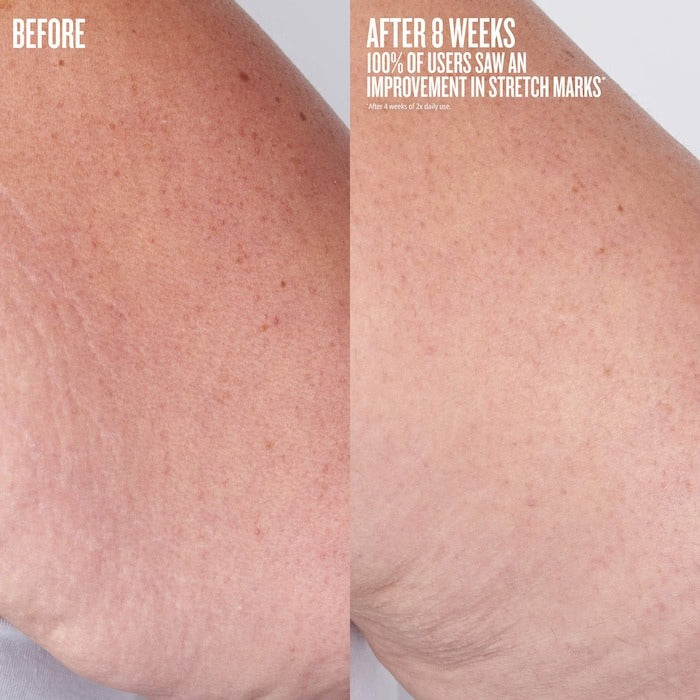 Beija Flor™ Body Oil - GLAM MODA