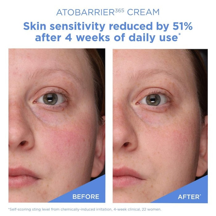 Mini Atobarrier365 Cream Moisturizer With Ceramides & Niacinamide For Skin Moisture Barrier Repair - GLAM MODA