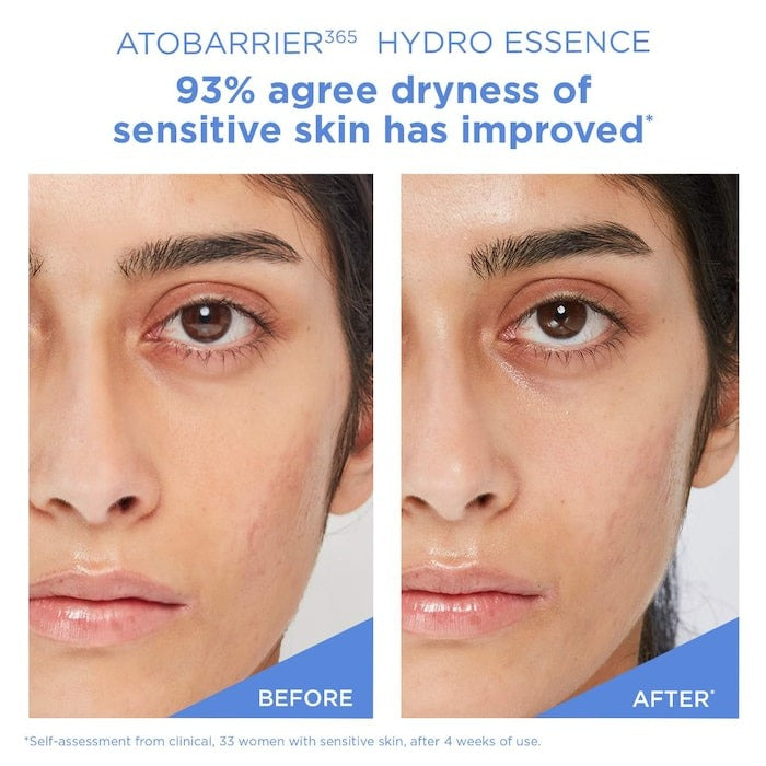 Atobarrier365 Hydro Essence With Hydrating Amino Acids For Skin Moisture Barrier Repair - GLAM MODA