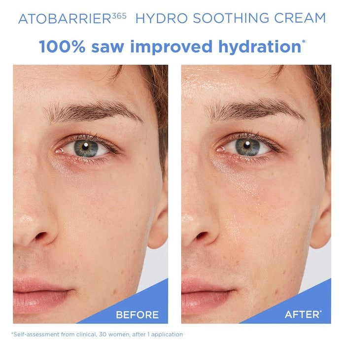 Atobarrier365 Cooling Hydro Soothing Gel-Cream Moisturizer With Ceramides For Skin Moisture Barrier Repair - GLAM MODA