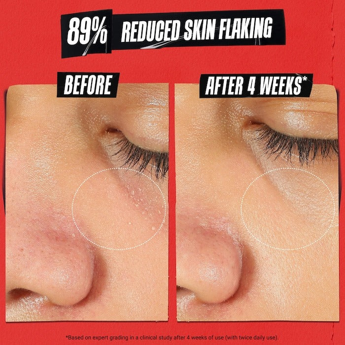 Ultra Facial Meltdown Recovery Medicated Cream with Colloidal Oatmeal - GLAM MODA