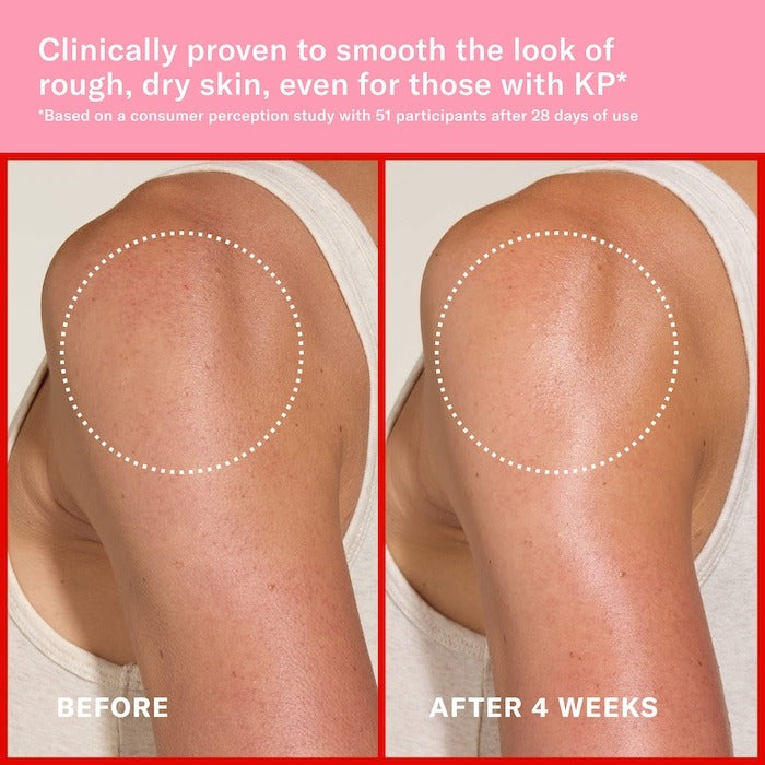 Pink Algae Pro-Retinol Body Butter for Anti-Aging and KP - GLAM MODA