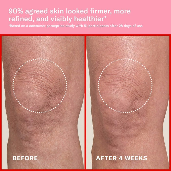Pink Algae Pro-Retinol Body Butter for Anti-Aging and KP - GLAM MODA