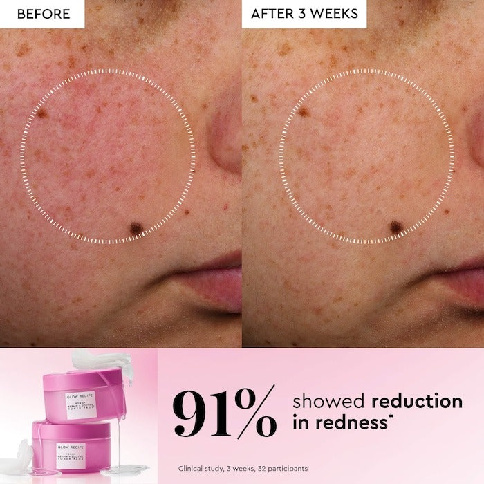 PDRN Repair + Soothe Korean Prickly Pear Toner Pads For Skin Barrier Repair - GLAM MODA