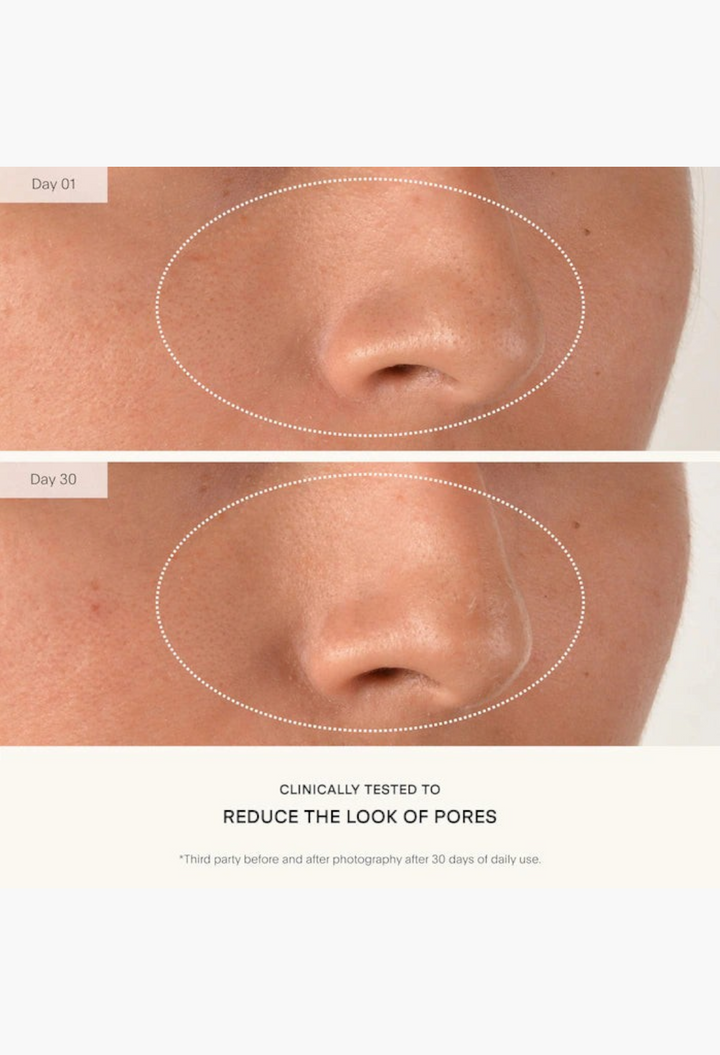 GLAM MODA clinical before and after comparison showing reduced pore size on a nose after 30 days of serum use.
