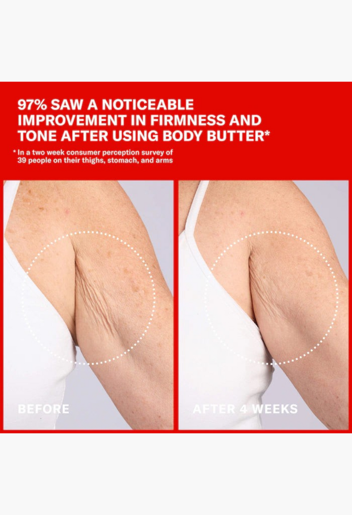 GLAM MODA before and after comparison showing improved skin firmness and reduced fine lines on an upper arm