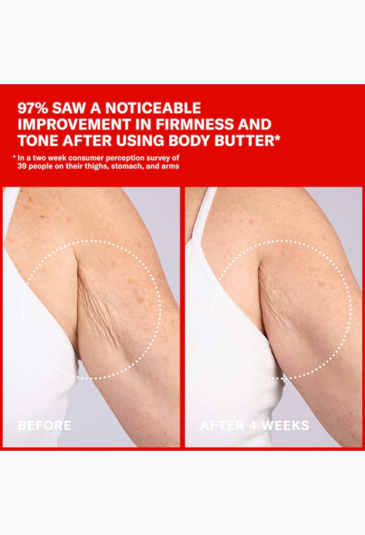 GLAM MODA before and after comparison showing improved skin firmness and reduced fine lines on an upper arm.