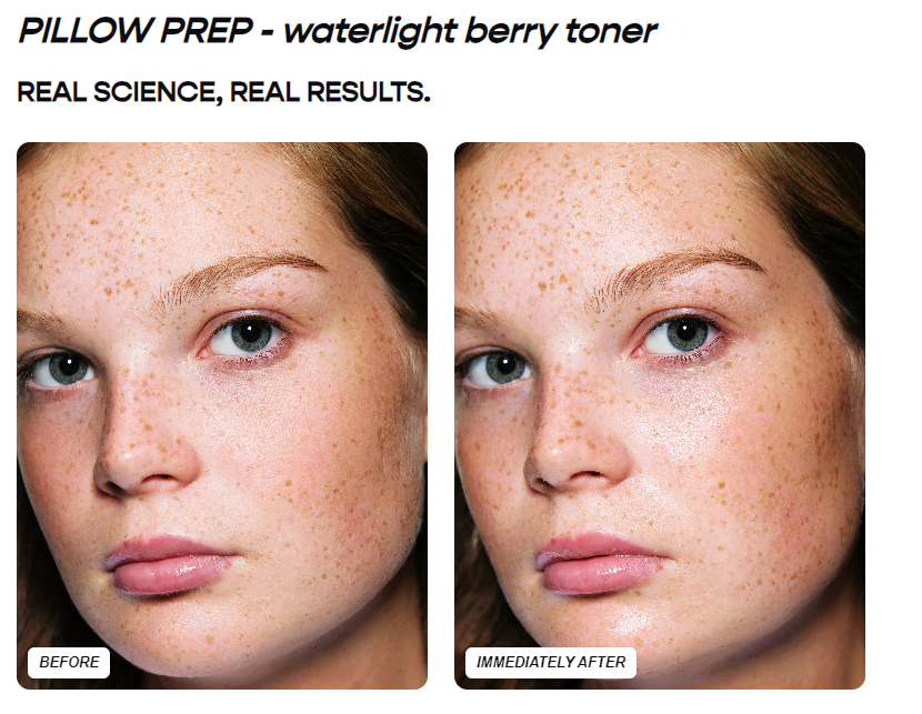 BREAKOUT-PRONE SKIN KIT - GLAM MODA